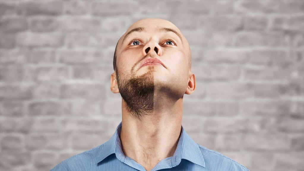Могат ли да се получат естествени резултати с трансплантация на брада?