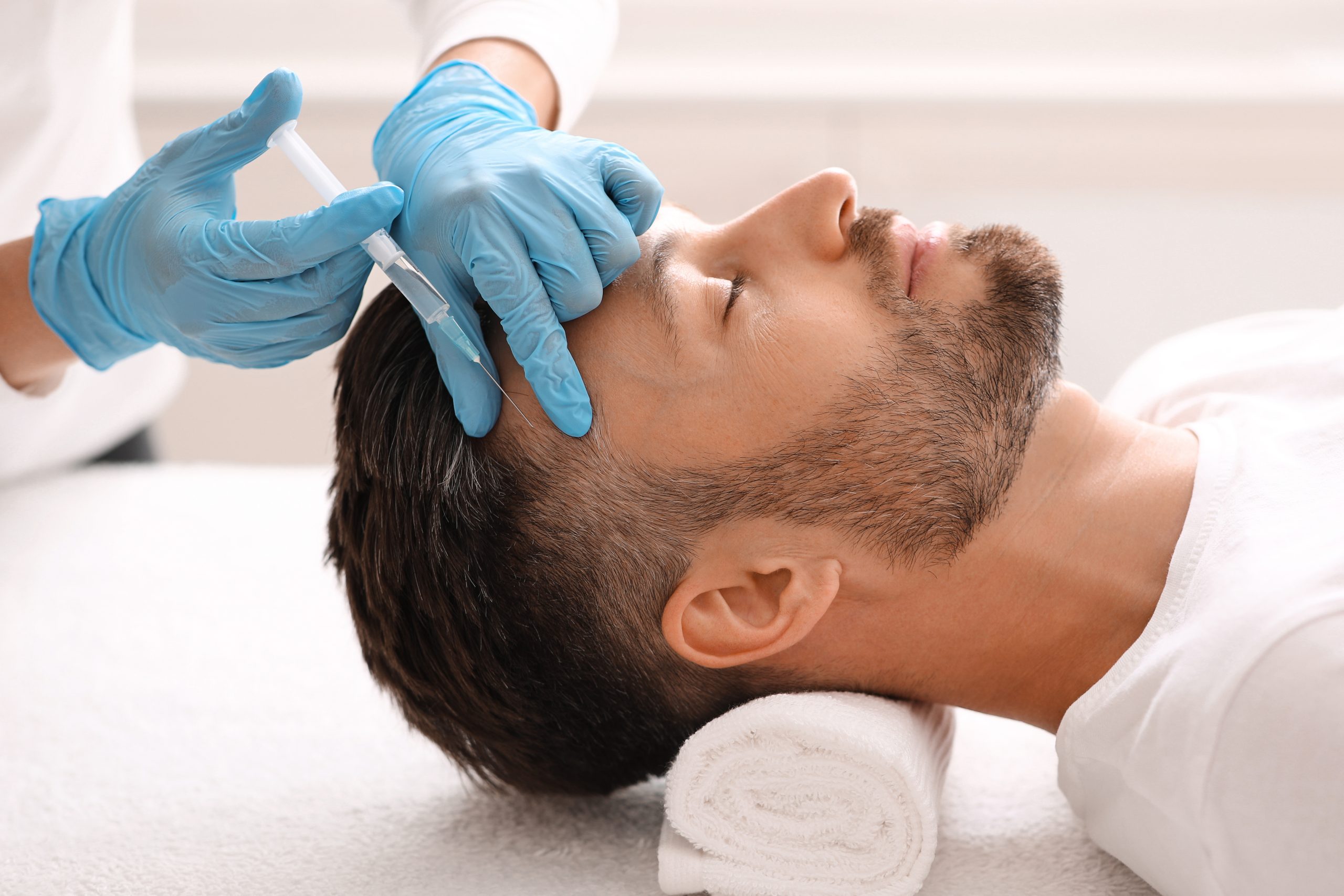 What is Hair Mesotherapy? How is it applied?